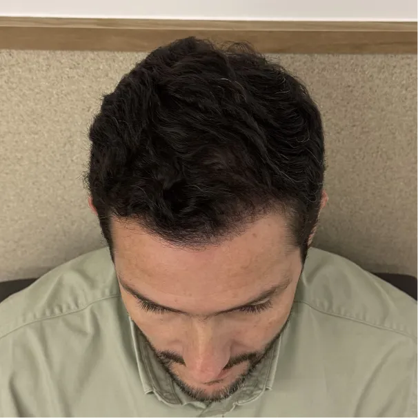 Imagem depois — Depois